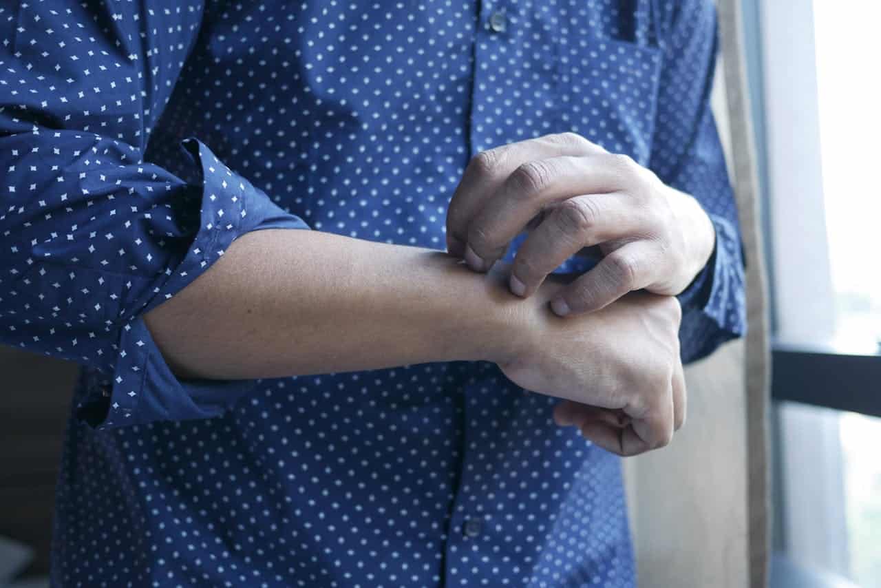 Skin Picking Disorder: Why Willpower Never Works